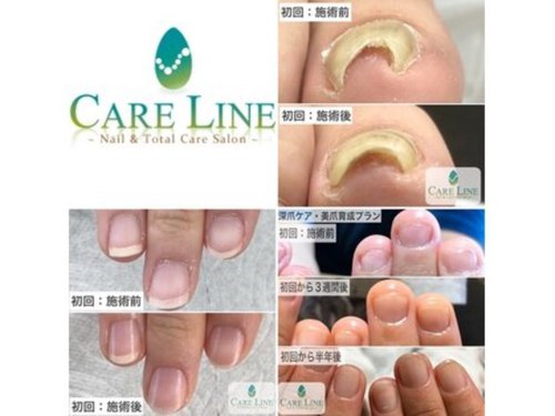 ケアライン 熊谷(CARE LINE)(埼玉県熊谷市柿沼676)