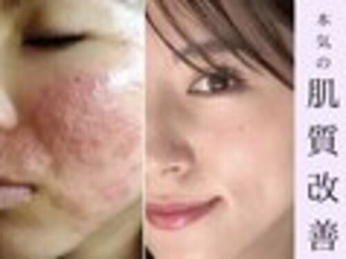 エステサロンベルジュール(広島県広島市佐伯区楽々園2-1-32 ルミナス楽々園202)